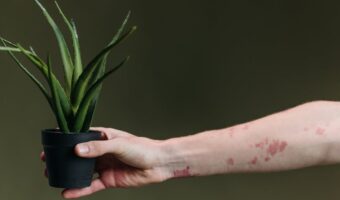 Cómo mejorar la apariencia de arrugas y manchas en manos y brazos con un remedio casero