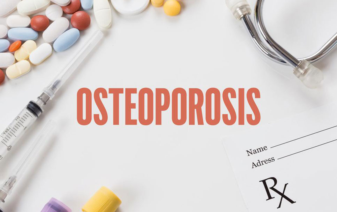 Effective Strategies to Support Bone Health and Manage Osteoporosis Risk