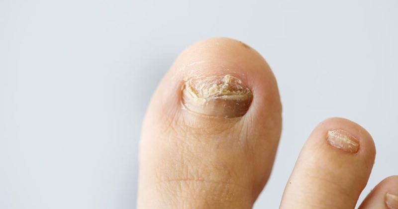 Practical Guide to Daily Nail Care and Hygiene